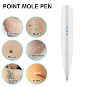 Laser Plasma Mole Pen