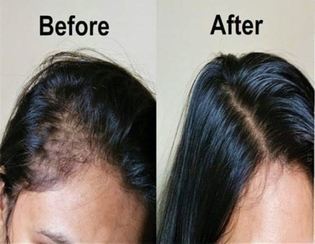 30/20/10 ML Effective Hair Growth Serum Fast Thick for Hair Prevent Hair Loss Damaged Hair Repair Natural Hair Care Products