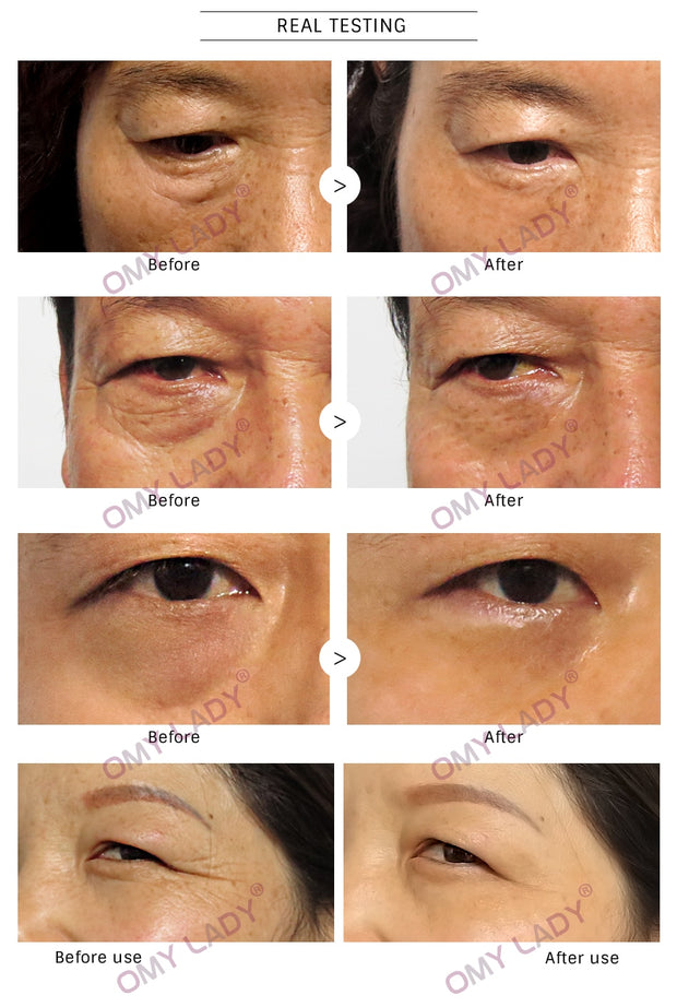 OMY LADY Eye Cream Instant Remove Eyebags Firming Eye Anti Puffiness Dark Circles Under Eye Anti Wrinkle Anti Age Eye Care