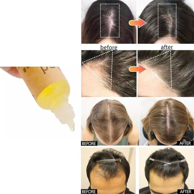 30/20/10 ML Effective Hair Growth Serum Fast Thick for Hair Prevent Hair Loss Damaged Hair Repair Natural Hair Care Products
