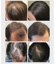 Load image into Gallery viewer, Hair Care Hair Growth Essential Oils Essence Original Authentic 100% Hair Loss Liquid Health Care Beauty Dense Hair Growth Serum
